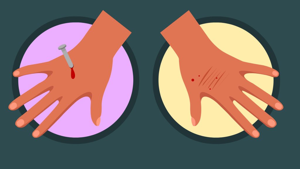 first aid for open wounds